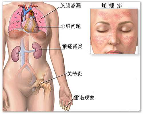 怎么确定胚胎停育*代生流程