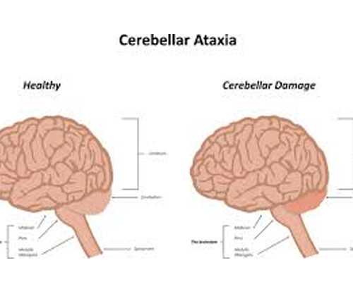 南宁医科大试管成功率是多少 南宁供卵试管婴儿的六大医院简介 ‘孕囊形状判