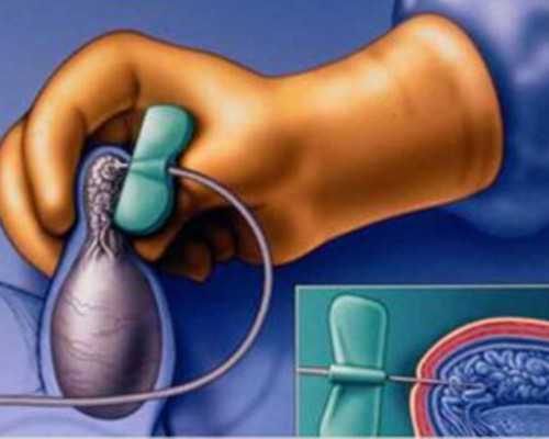 最好大连助孕试管医院排名 2026大连市妇女儿童医疗中心供精试管费用一览 ‘四