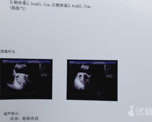 深圳实验室三代试管婴儿 深圳市妇幼保健院试管婴儿技术怎么样 ‘看孕囊形状