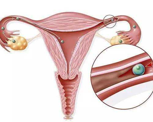 妻子不能生育可以代生吗,美国试管婴儿移植后如何做有利于囊胚着床？_上海私