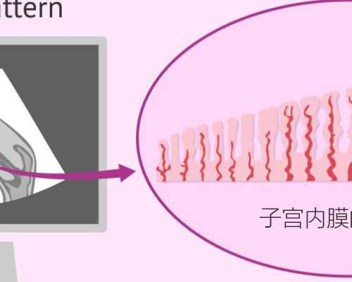 北京大学第一医院可以保三代试管吗 在北京协和做试管可以报销吗? ‘孕10周