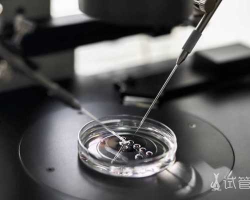 上海国际和平医院做供卵 上海国妇婴医院做试管婴儿怎么样?三代试管成功率高