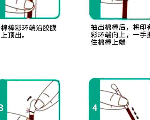 乌鲁木齐哪家医院可以做试管婴儿 2026乌鲁木齐试管费用纳入医保了吗？ ‘胎囊