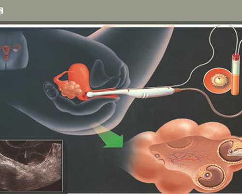 山东大学附属医院生殖医院做试管 山东试管婴儿应该去哪做? ‘四维单子上有男