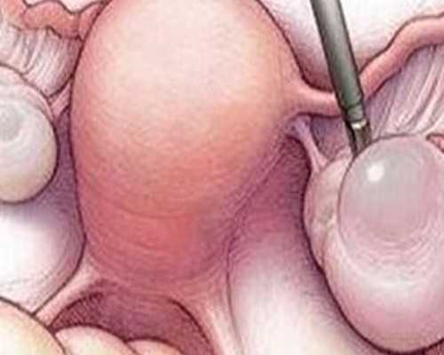 拉萨供卵试管有几家 拉萨阜康医院2026年试管婴儿费用解析 ‘b超单上的数据能