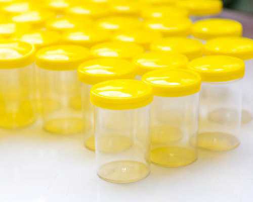 代生代怀,北京三代试管供卵价格,以最纯洁的爱来呵护你_南京有供卵试管机构吗