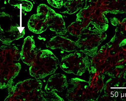 找人代生怎么个代法,国内三代试管成熟吗？三代试管具体有哪些优势？-生男生
