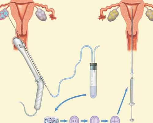 深圳生殖遗传医院 【2026试管公开】：深圳妇幼做三代试管一个周期多少钱？