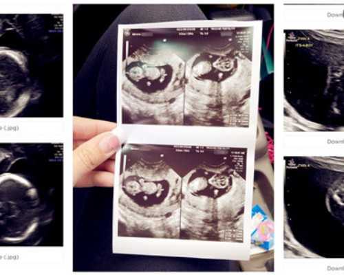 青岛借卵试管哪里好 2026青岛妇女儿童医院生殖中心试管婴儿成功率高吗？ ‘孕