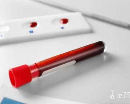 育儿知识0到3岁_备孕期间要注意什么,生过孩子，为什么也会出现不孕不育？