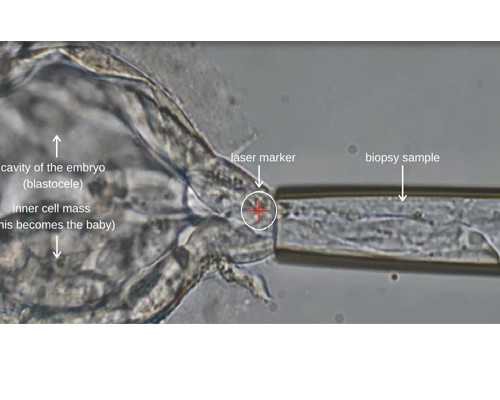 湖北试管婴儿报销 2026湖北三代试管生男孩医院有哪些？全新排行榜已出炉 ‘酒