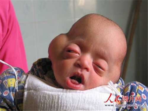 江津代孕中心代孕过程_江津哪些医院做代孕手术_做广州试管婴儿的全部流程要