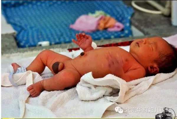 荷泽做代孕哪个医院好_荷泽可以代孕的吗_北京三代试管婴儿医院好不好？